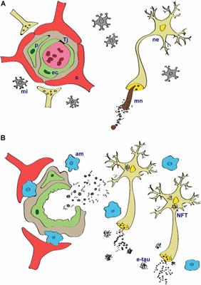 Tau Protein and Its Role in Blood–Brain Barrier Dysfunction